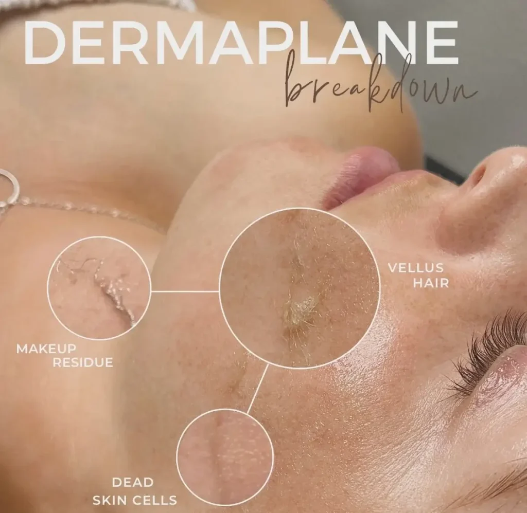 Dermaplaning in Gig Harbor, WA, at Haven Permanent Cosmetics & Aesthetics