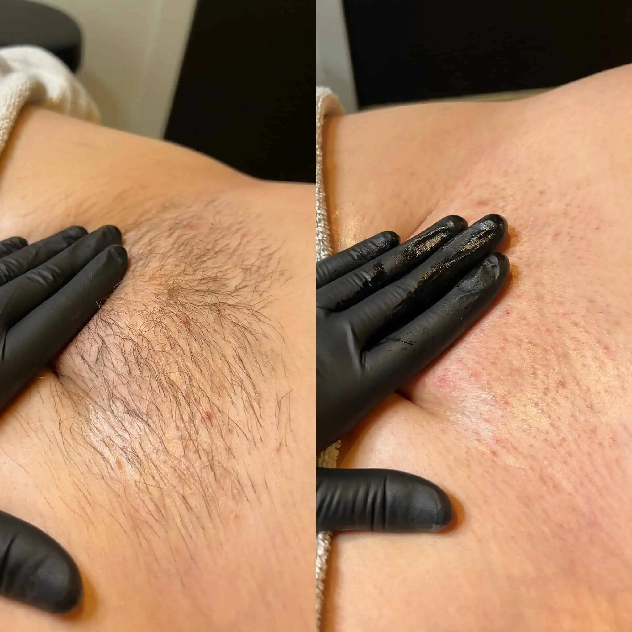 Waxing Before and After2