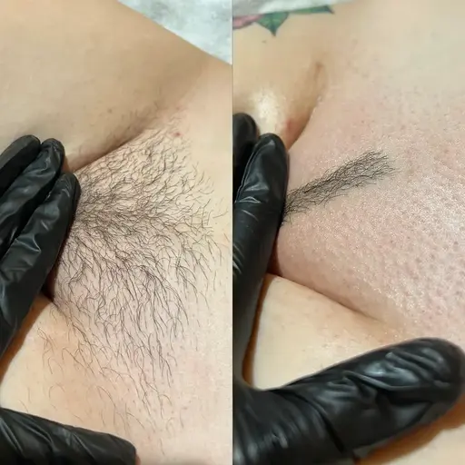 Waxing Before and After at Haven Permanent Cosmetics & Aesthetics in Gig Harbor, WA