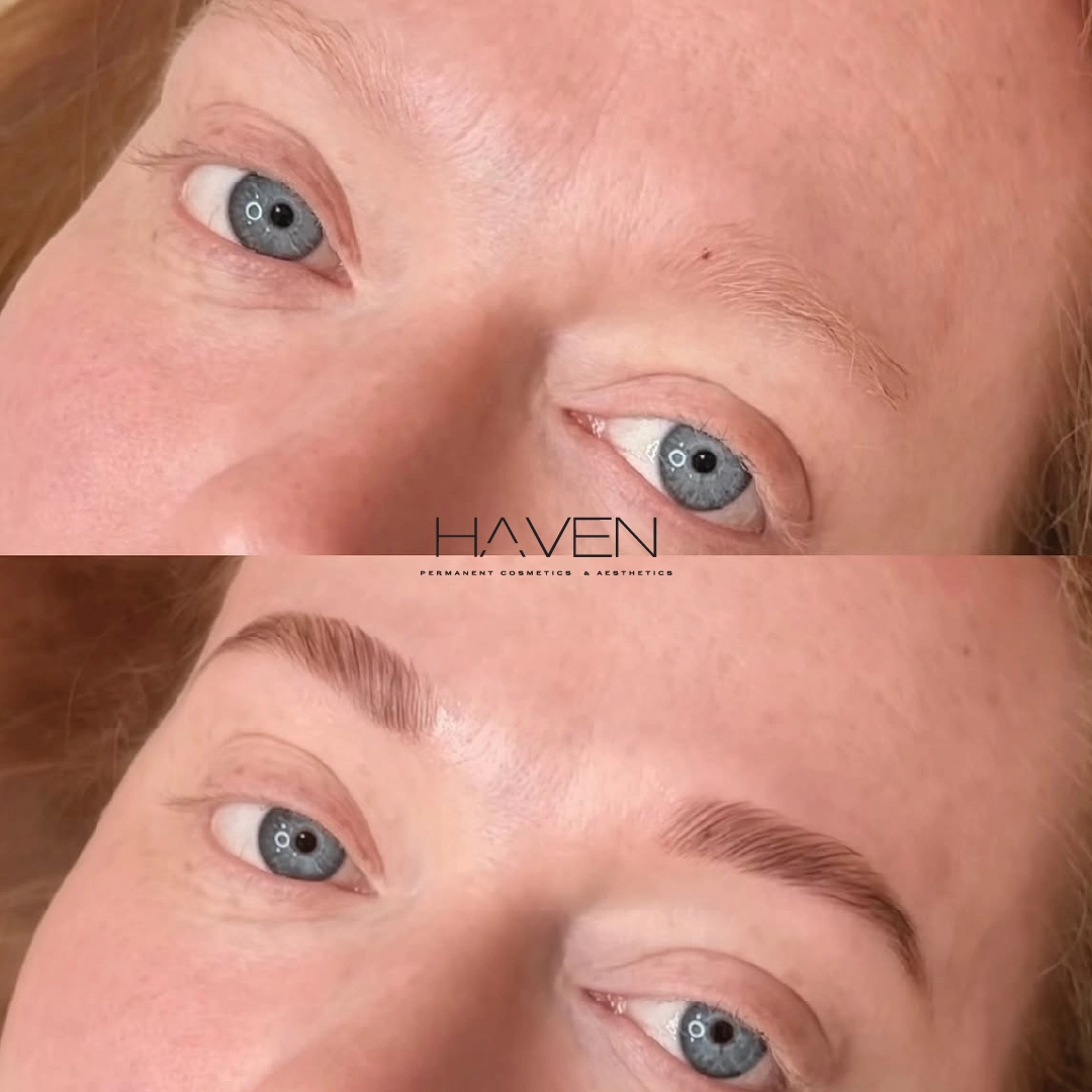brow lamination-before-after-a