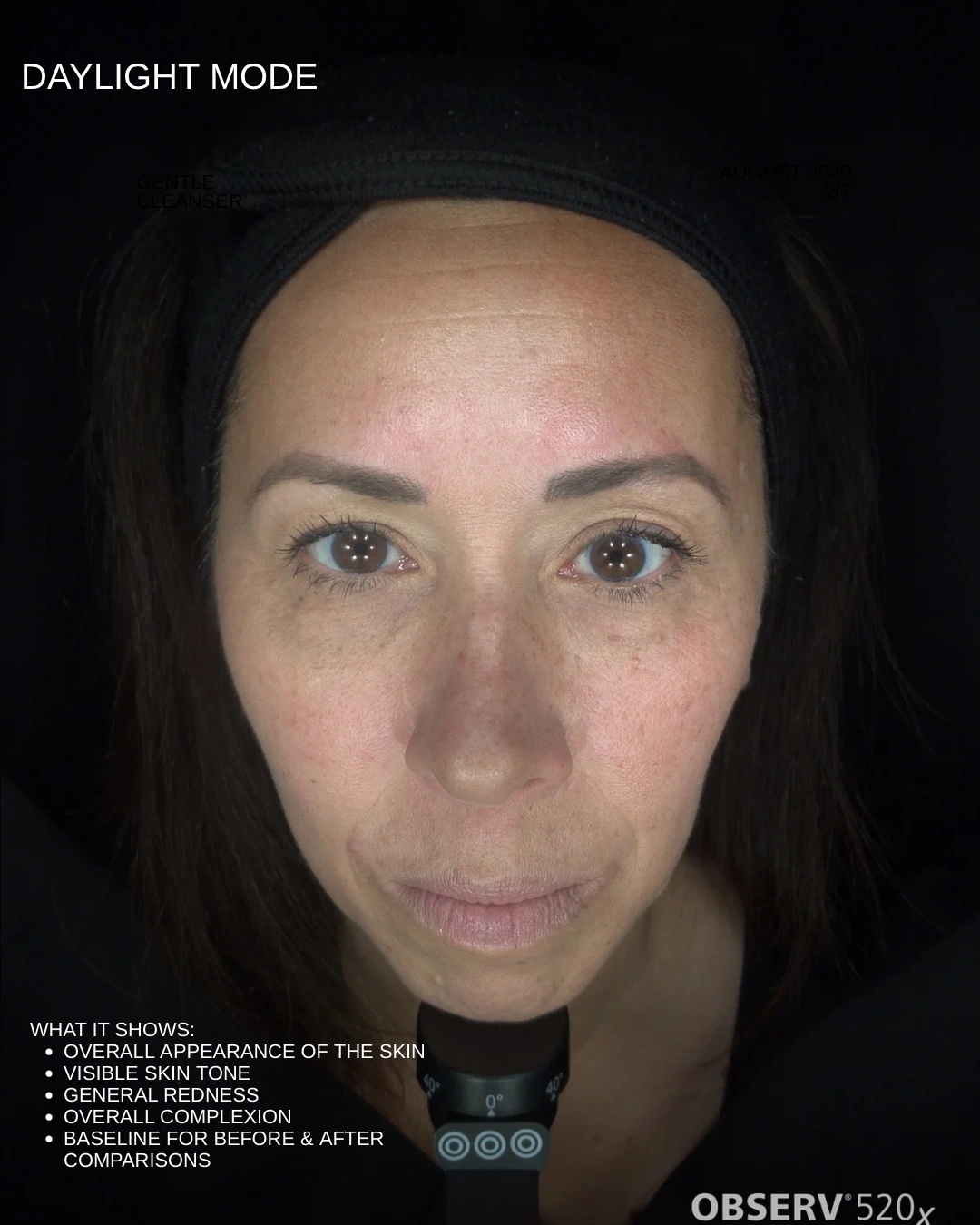 Aesthetic Summer Skincare Carousel Instagram Post - 2