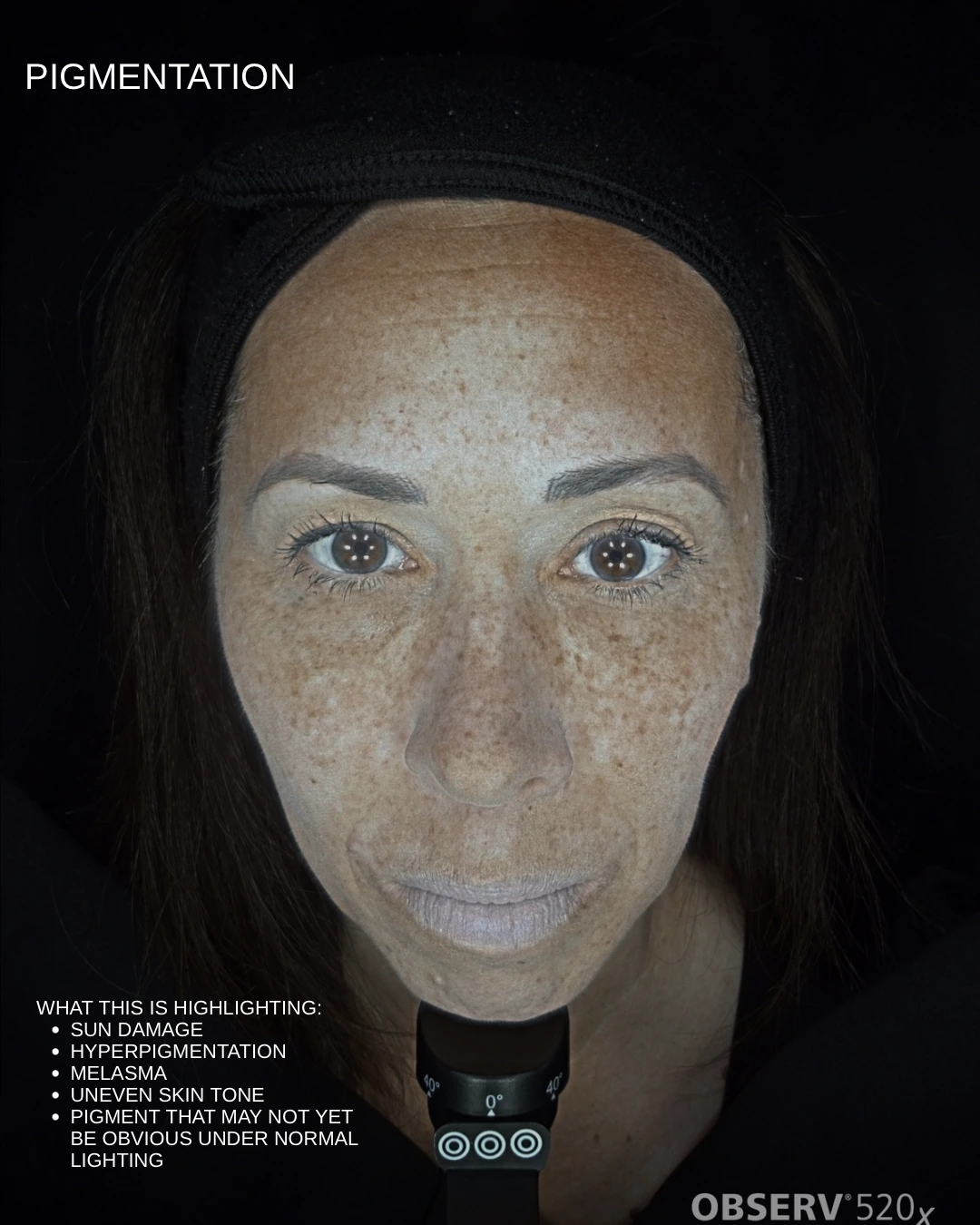 Aesthetic Summer Skincare Carousel Instagram Post - 4