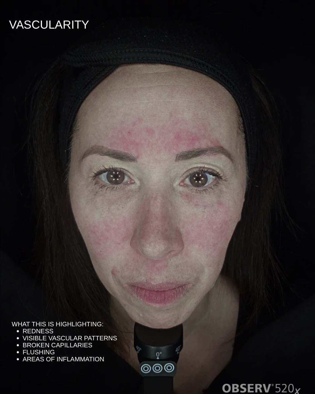 Aesthetic Summer Skincare Carousel Instagram Post - 5