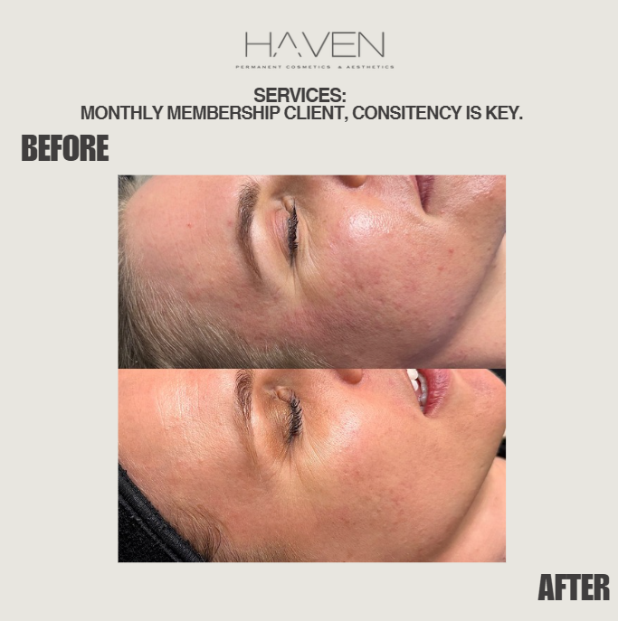 Monthly Membership female client's facial treatment before and after results at Haven Permanent Cosmetics & Aesthetics in Gig Harbor, WA
